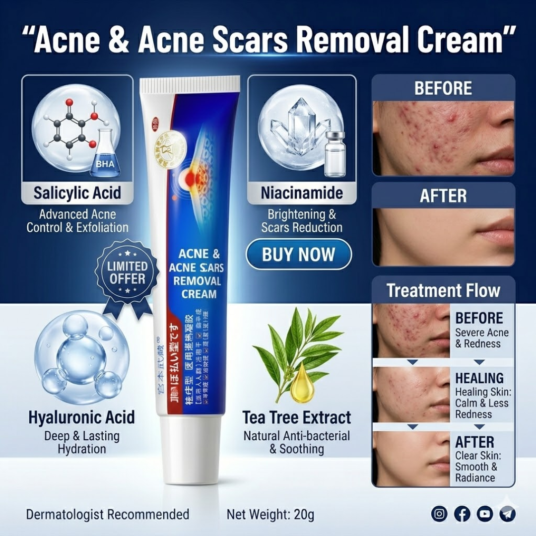 Acne & Acne Scars Removal Cream | Salicylic Acid + Niacinamide + Hyaluronic Acid + Tea Tree |